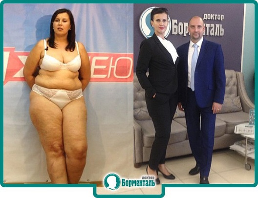 Большая иллюстрация к новости «Триумф Елены Куликовой: чудеса косметологии для успешного похудения» Большая иллюстрация к новости «Триумф Елены Куликовой: чудеса косметологии для успешного похудения»